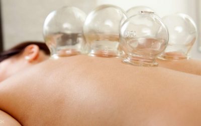 Pengobatan Bekam, Praktik Pengobatan Yang Melengkapi Herbal